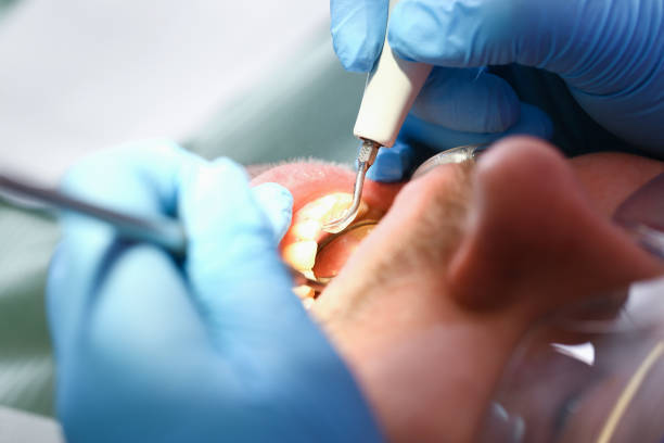 Trusted UT Emergency Dental Service Experts