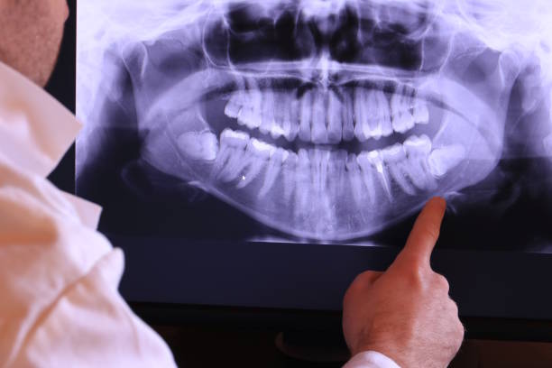 Best Emergency Root Canal Therapy in Uintah, UT