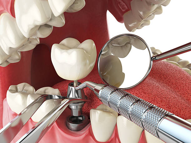 Best Emergency Denture Repair in Uintah, UT